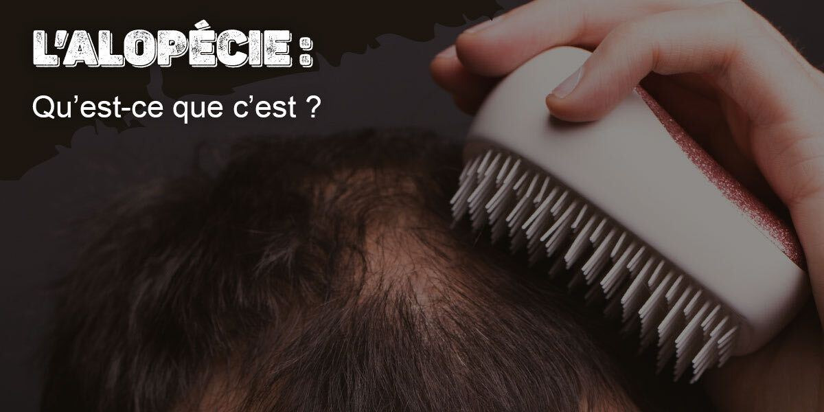 <strong>L’alopécie, c’est quoi ?</strong>