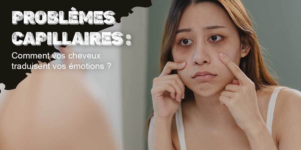 Problèmes capillaires : comment vos cheveux traduisent vos émotions.
